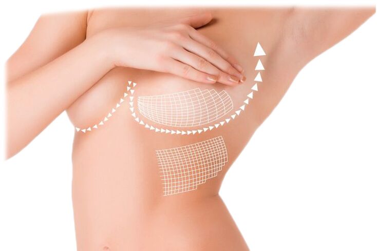 Azione delle capsule Mammax per l'aumento del seno